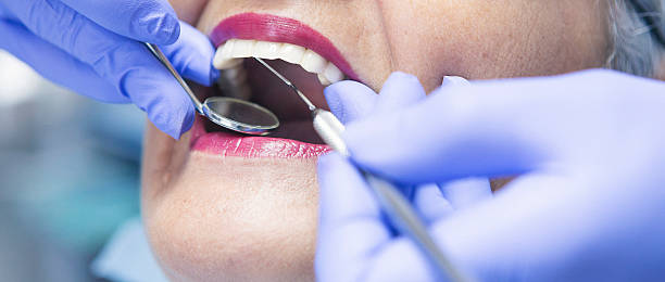 Best Broken or Chipped Tooth Repair in Mount Pleasant, UT